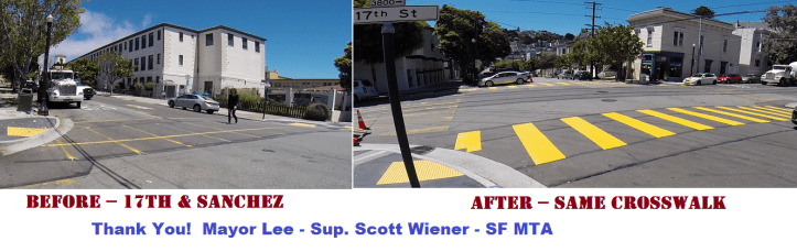 17th-Sanchez-Before-After